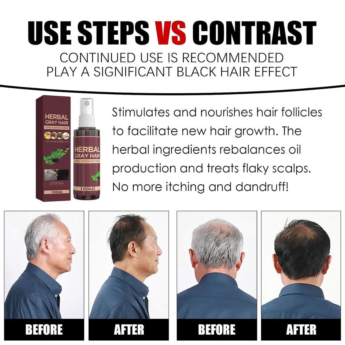 2Pcs Herbal Essence Hair Spray,Gray Hair Verse Essence Spray,Hair Darkening Conditioner,Reverse Grey Hair,Hair Coloring Essence for 4 Weeks Gradual Results(100Ml)