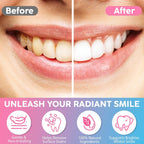 2Pack Niacinamide Whitening Toothpaste - Niacinamide Toothpaste - Help for Fresh Breath & Enamel Safe