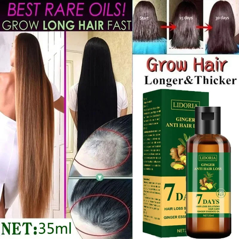 Ginger Hair Growth Essential Oil Anti-Loss Hair Regrowth Serum Fast Growth Prevent Baldness Treatment Alopecia Hair Care Product