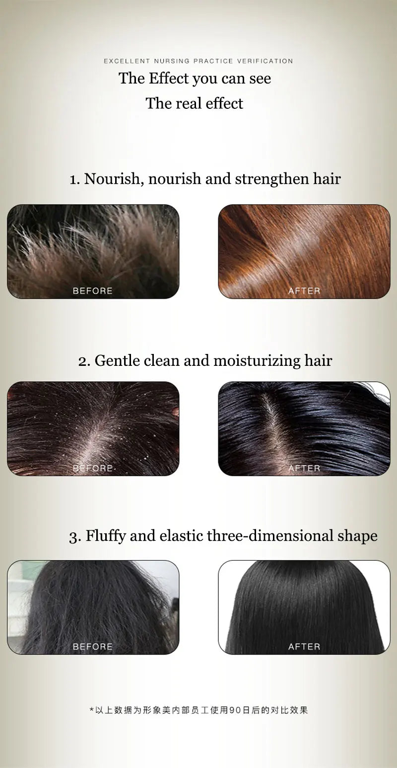 Chinese Formula Ginger Shampoo for anti Hair Loss Fast Growth Hair Grow Thicker Dense Control Hair Oil Treatment Dandruff 300Ml