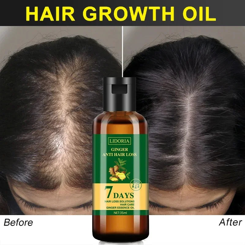 Ginger Hair Growth Essential Oil Anti-Loss Hair Regrowth Serum Fast Growth Prevent Baldness Treatment Alopecia Hair Care Product