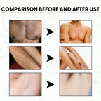 Hair Removal Cream