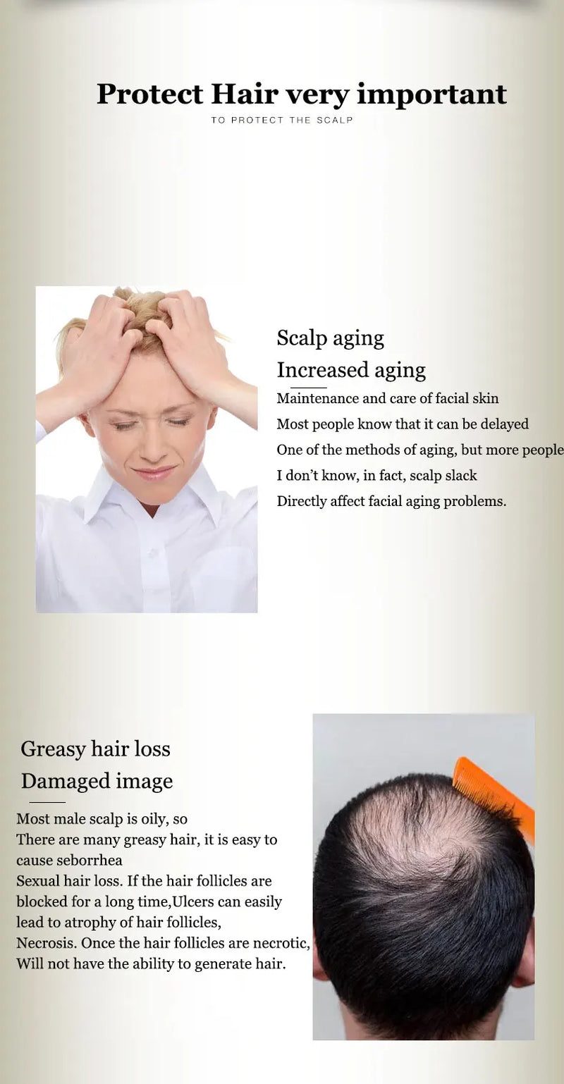 Chinese Formula Ginger Shampoo for anti Hair Loss Fast Growth Hair Grow Thicker Dense Control Hair Oil Treatment Dandruff 300Ml